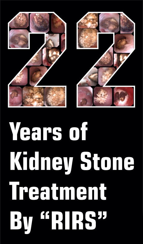 kidney-stone-treatment-by-rirs
